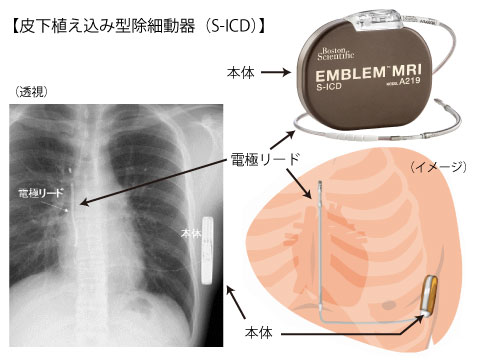 不整脈検査・治療 | 東京慈恵会医科大学附属病院 循環器内科