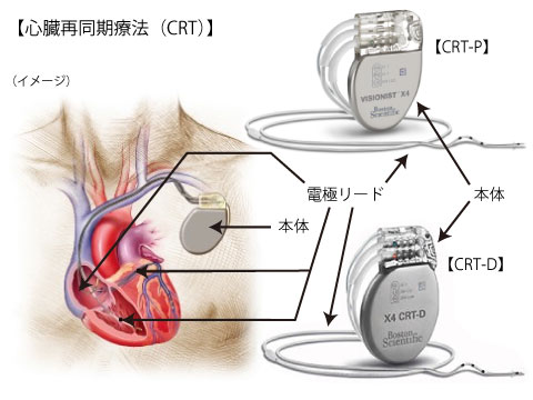 不整脈検査・治療 | 東京慈恵会医科大学附属病院 循環器内科