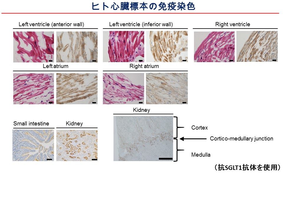 ヒト心臓標本の免疫染色