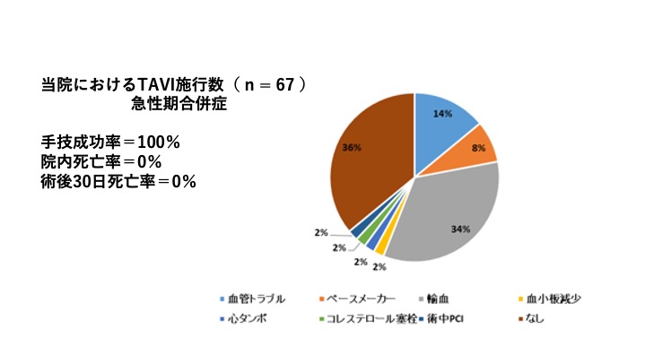 経カテーテル的大動脈弁置換術（TAVI）